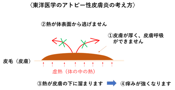 図② 熱が皮膚の下にこもりやすい状態（イメージ）