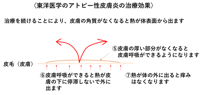 図④ 補足イメージ（図③と並列）