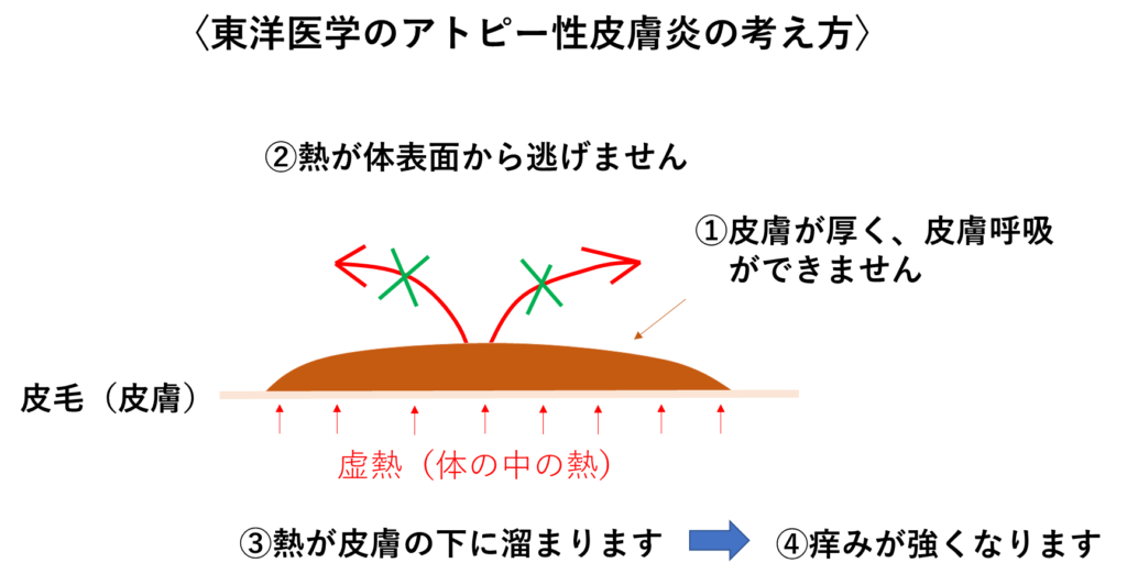 アトピー性皮膚炎専門の鍼灸院~皮膚の健康と、心の安心をサポートいたします~の掲載画像