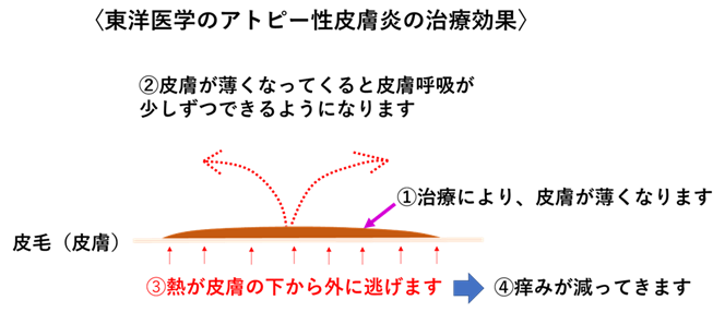 図③ 熱が外へ逃げやすい状態へ整える(イメージ)